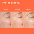 Nyumi Collagen Gummies For Glowing, Hydrated, Youthful Skin - Vitamin C & Hyaluronic Acid | Grocsy