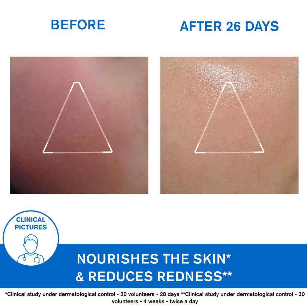 Uriage Xemose Face Cream | Grocsy