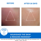 Uriage Xemose Face Cream | Grocsy