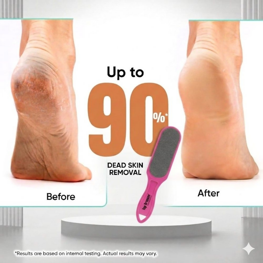 Bronson Professional Double Sided Emery Foot File Callus, Dead Skin Remover | Grocsy