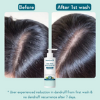 WishCare Aha Bha Anti-Dandruff Shampoo | Grocsy