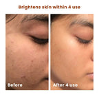 The Skin Story Salicylic Acid Brightening Face Scrub | Grocsy