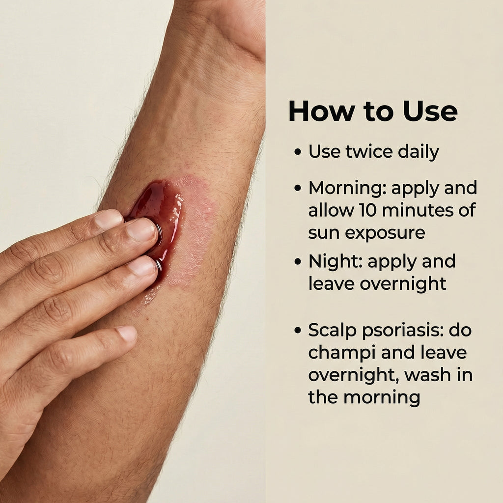 Vedicderm Psoriasis Oil 2-in-1 Skin + Scalp Relief Oil | Grocsy