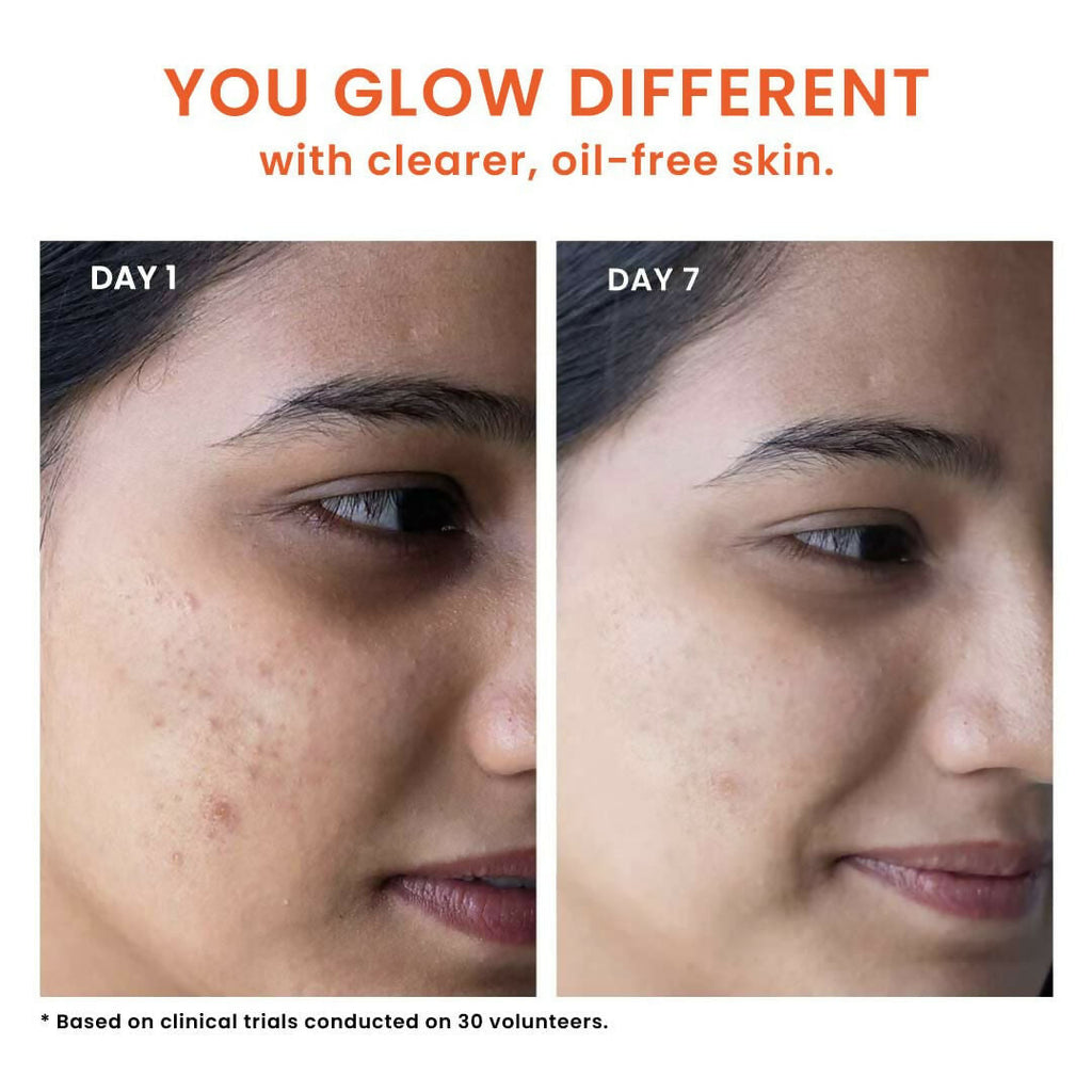 Foxtale Oil & Acne Control Face Wash | Grocsy