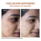 Foxtale Oil & Acne Control Face Wash | Grocsy