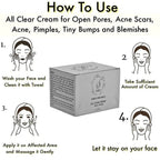 Saroj Organics All Clear Cream For Acne, Pimples | Grocsy