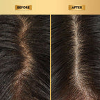 The Skin Story Anti-Dandruff Hair Scalp Serum | Grocsy