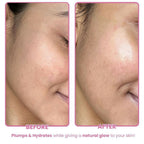 The Skin Diet Company Beetroot Moisturiser Lightweight, Non-Greasy - Dry/Oily Skin + Hyaluronic Acid | Grocsy