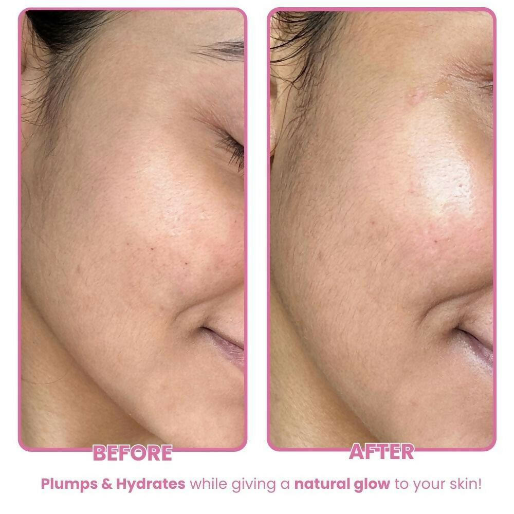 The Skin Diet Company Beetroot Moisturiser Lightweight, Non-Greasy - Dry/Oily Skin + Hyaluronic Acid | Grocsy