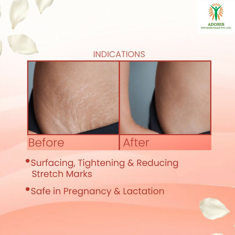 Adonis Strie Stretch Mark Cream | Grocsy