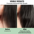 Nykaa Naturals Advanced Hair Growth Shampoo With Rosemary & Naturally Derived Niacinamide | Grocsy