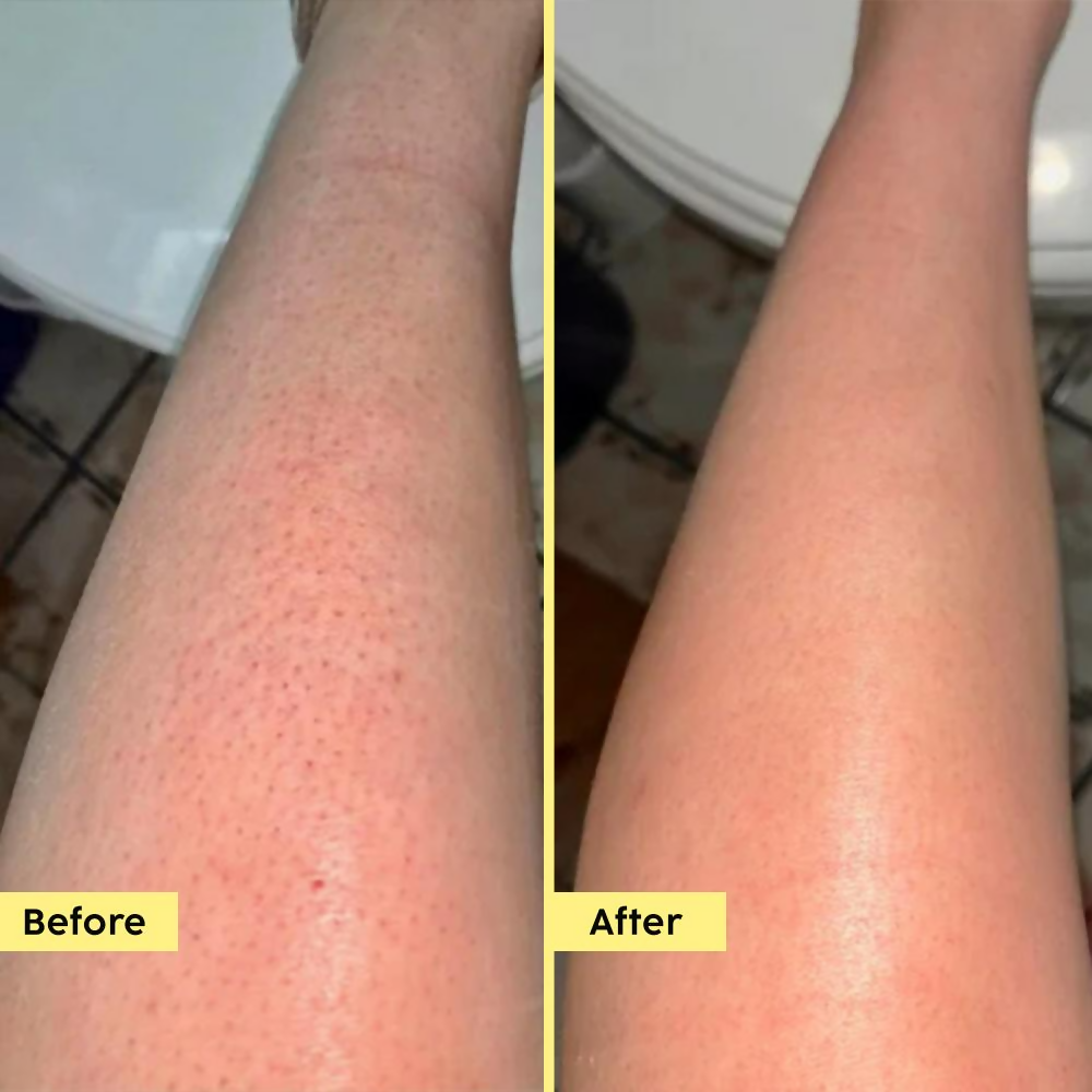PLIX The Plant Fix Pineapple 5% Lactic Acid Body Wash Exfoliates Dry, Rough & Strawberry Skin | Grocsy