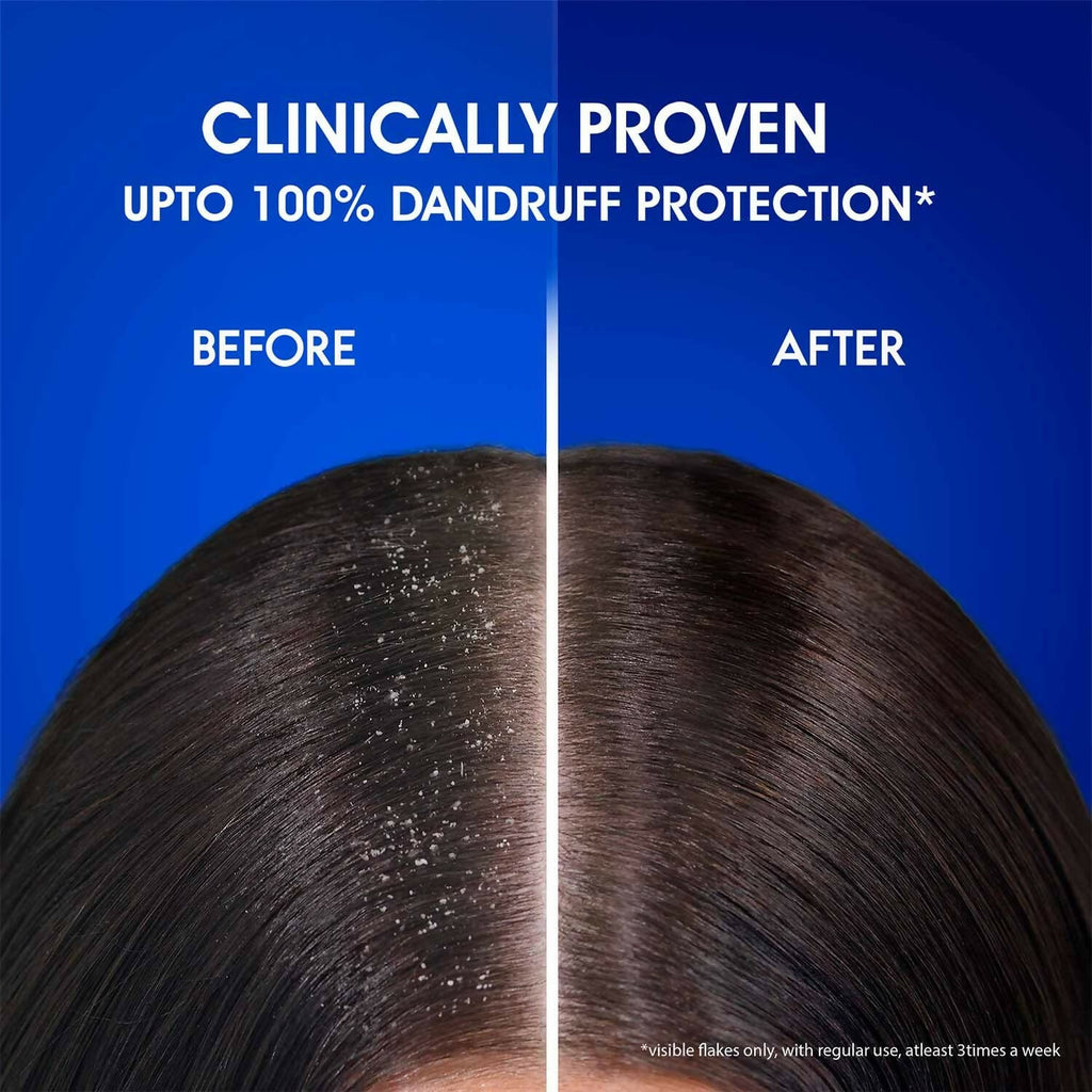 Head & Shoulders Silky Black Anti Dandruff Shampoo | Grocsy