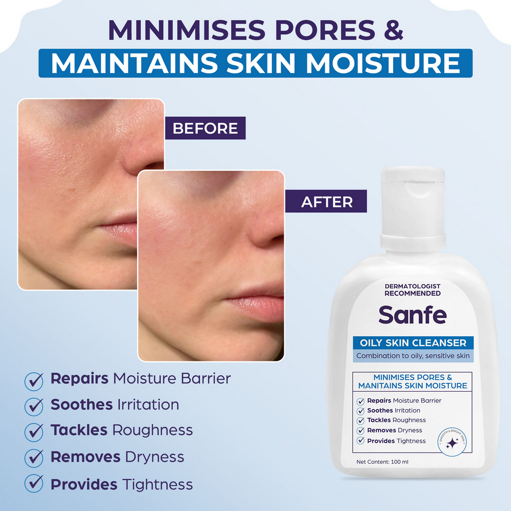Sanfe Oily Skin Cleanser Minimises Pores & Maintains Skin Moisture cetaphil skin repair Face Wash | Grocsy