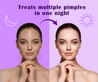 Urban Yog Acne Curvy Pimple Patch - Invisible Facial Stickers cover | Grocsy