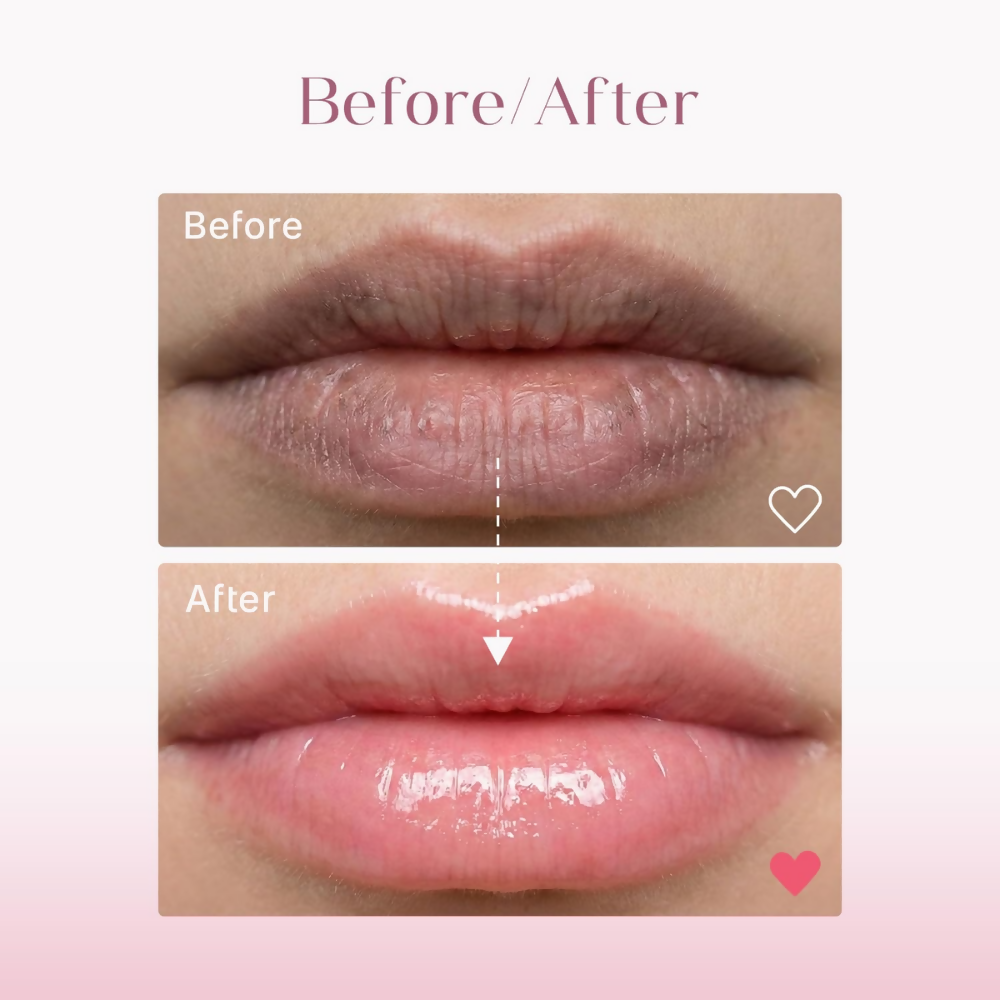Seoulskin Brightening Lip Balm with SPF 50 PA++ | Grocsy