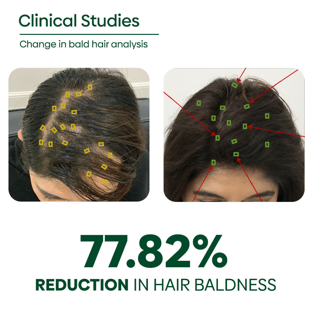 Rishi Natural Adivasi Hair Oil | Grocsy