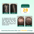 Orgatre Hair Growth Oil With 28 Herbal Oils ??Promotes Hair Growth, Reduces Hair Fall & Dandruff | Grocsy