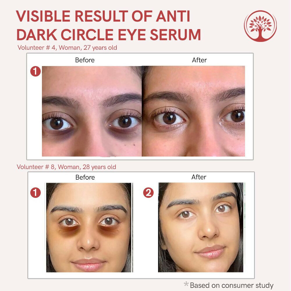 Ivory Natural Dark Circle Eye Serum For Dark Eye Circles, Under-Eye Patches, Swollen Eyes | Grocsy