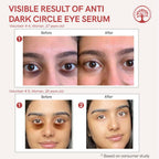 Ivory Natural Dark Circle Eye Serum For Dark Eye Circles, Under-Eye Patches, Swollen Eyes | Grocsy