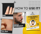 UrbanGabru Acne Pimple Patch - Invisible Facial Stickers Reduces Pimple Overnight | Grocsy
