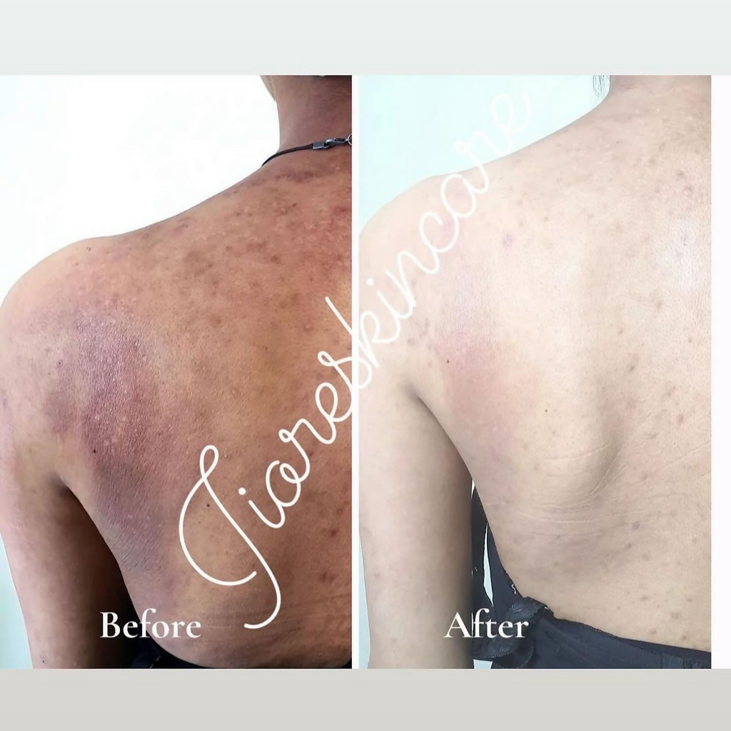 Pinkin Jiore skincare sinche Body Soap | Grocsy