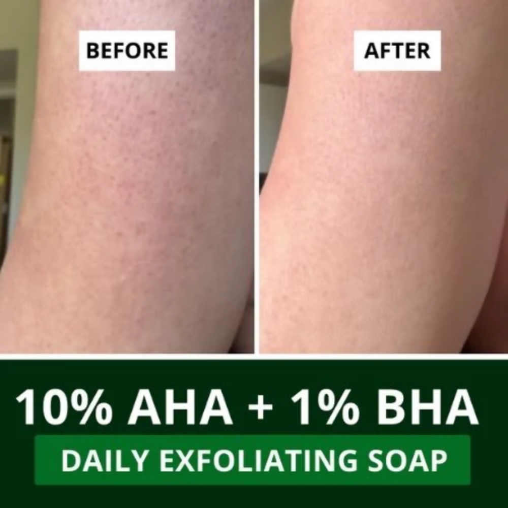 Bake 10% AHA + 1% BHA Scrub Treatment Soap | Grocsy