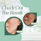 Skinaa Ocevia Skin Brightening Cream | Grocsy