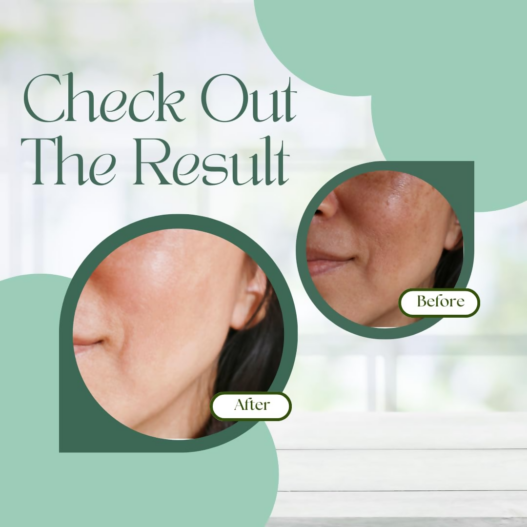 Skinaa Ocevia Skin Brightening Cream | Grocsy