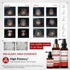 Derma Global High Potency Hair Growth Serum | Grocsy