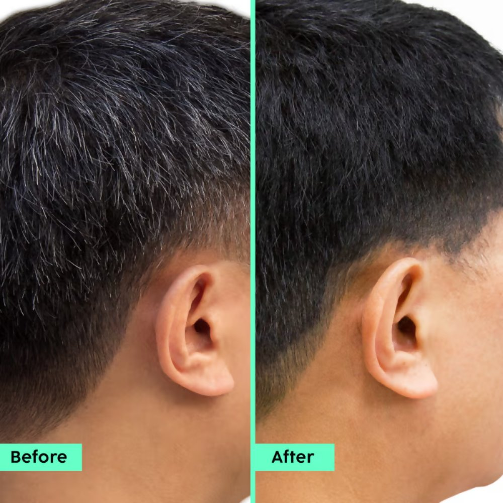 PLIX The Plant Fix Rosemary Advanced Hair Kit | Grocsy