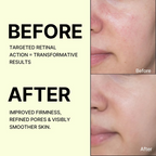 Celimax The Vita-A Retinal Shot Tightening Booster For Anti-Aging, Dark Spots & Wrinkles | Grocsy