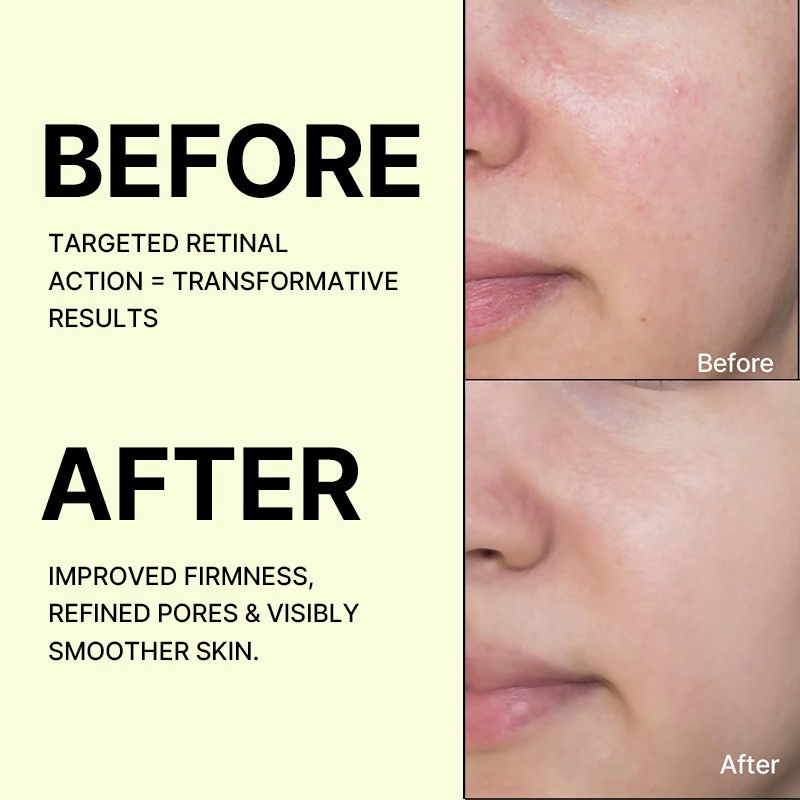 Celimax The Vita-A Retinal Shot Tightening Booster For Anti-Aging, Dark Spots & Wrinkles | Grocsy