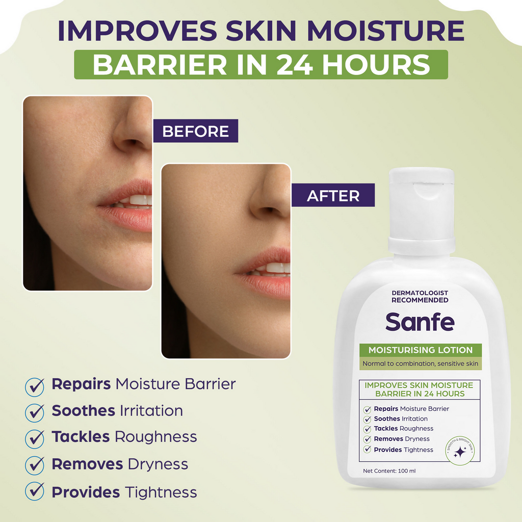Sanfe Moisturising Lotion Improves skin moisture in 24 hour Moisturizer | Grocsy
