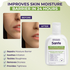 Sanfe Moisturising Lotion Improves skin moisture in 24 hour Moisturizer | Grocsy