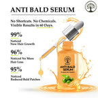 Ivory Natural Bald Serum For Baldness, Hair Thinning And Hair Fall | Grocsy