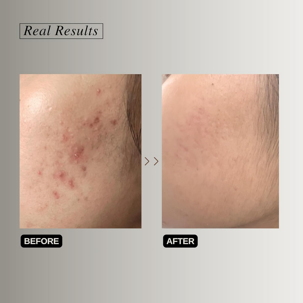 The Formularx Renaissance Gentle Retinol Complex Serum With Niacinamide & Bakuchiol | Grocsy