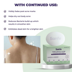 Sanfe Dark Spots & Acne Clearing Body Soap | Grocsy