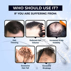 The Man Company Hair Growth Tonic | Grocsy