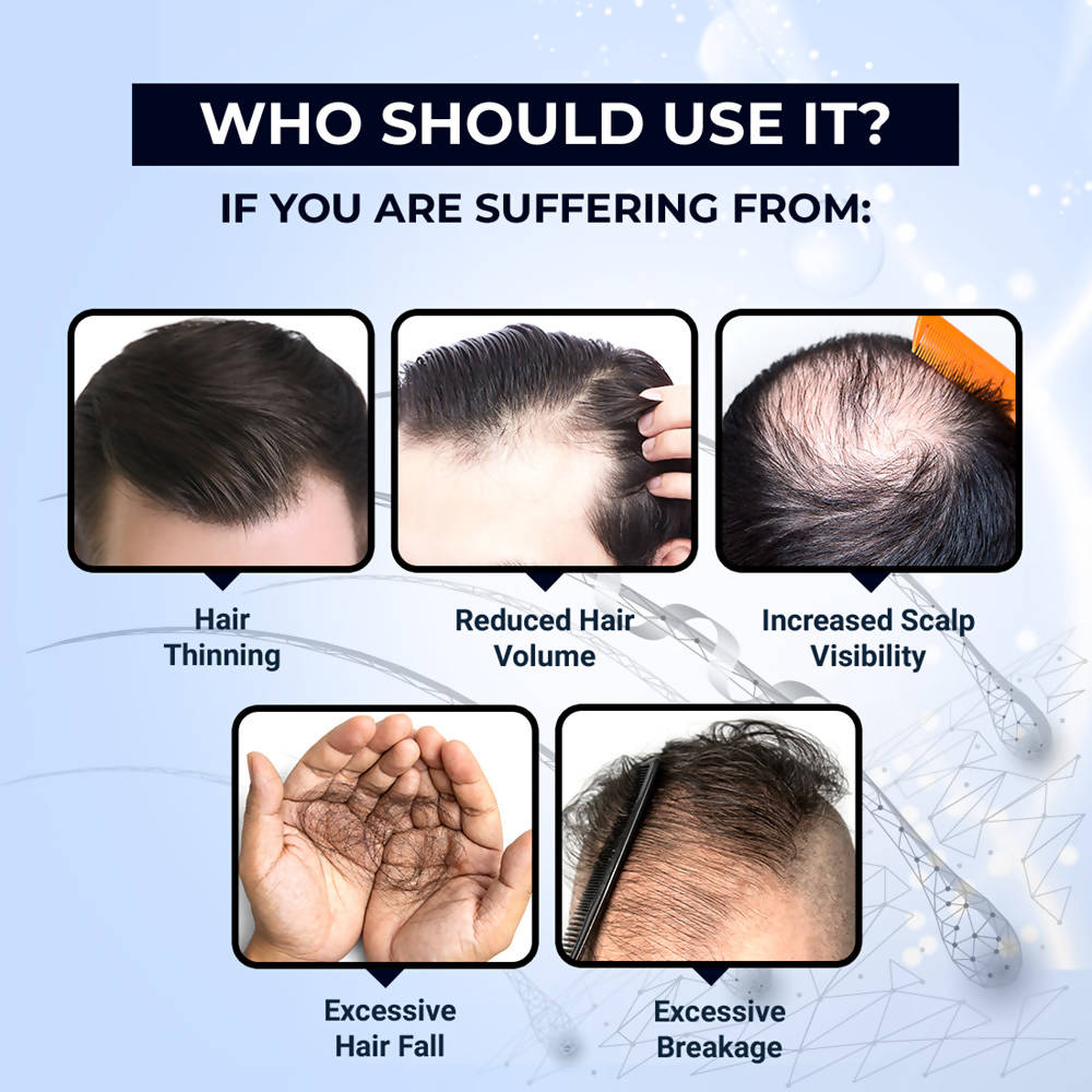 The Man Company Hair Growth Tonic | Grocsy