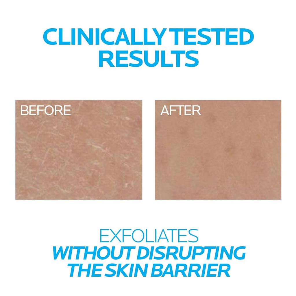 La Roche-Posay Lipikar Urea10% Roughness Smoothing Lotion | Grocsy