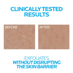 La Roche-Posay Lipikar Urea10% Roughness Smoothing Lotion | Grocsy