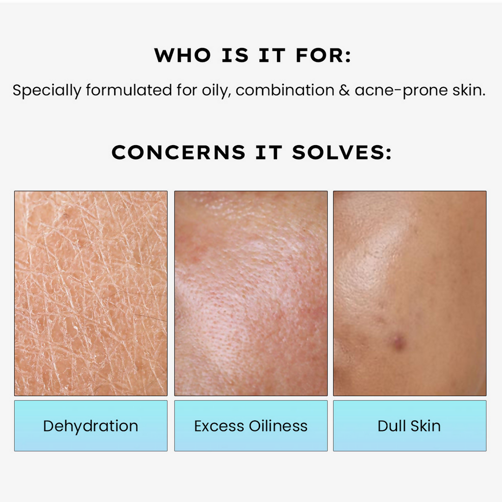 Hyphen 2% Cica Exosome Oil-Free Moisturizer 5% Niacinamide Controls Oil Non-sticky, Light Gel | Grocsy