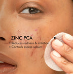 mCaffeine 2% Salicylic Acid Serum Clear Skin Acne Pads - Acne & Oil Control with Matcha Tea | Grocsy
