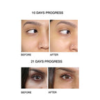 Skog Under Eye Repair Oil | Grocsy