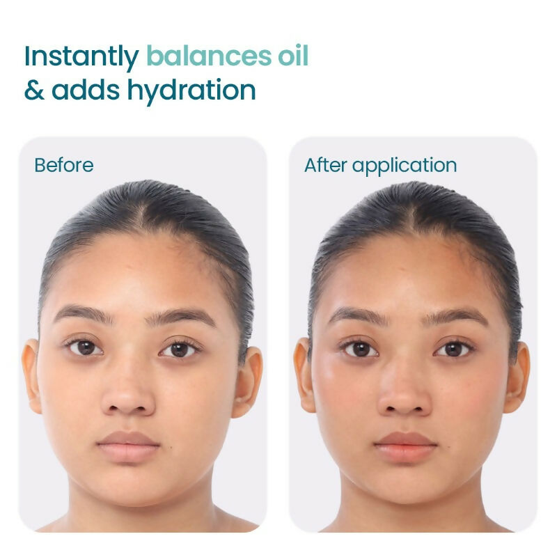 Wishcare 2:1:3 NMF Water Gel Moisturizer for Oily & Sensitive Skin, Oil-Free | Grocsy