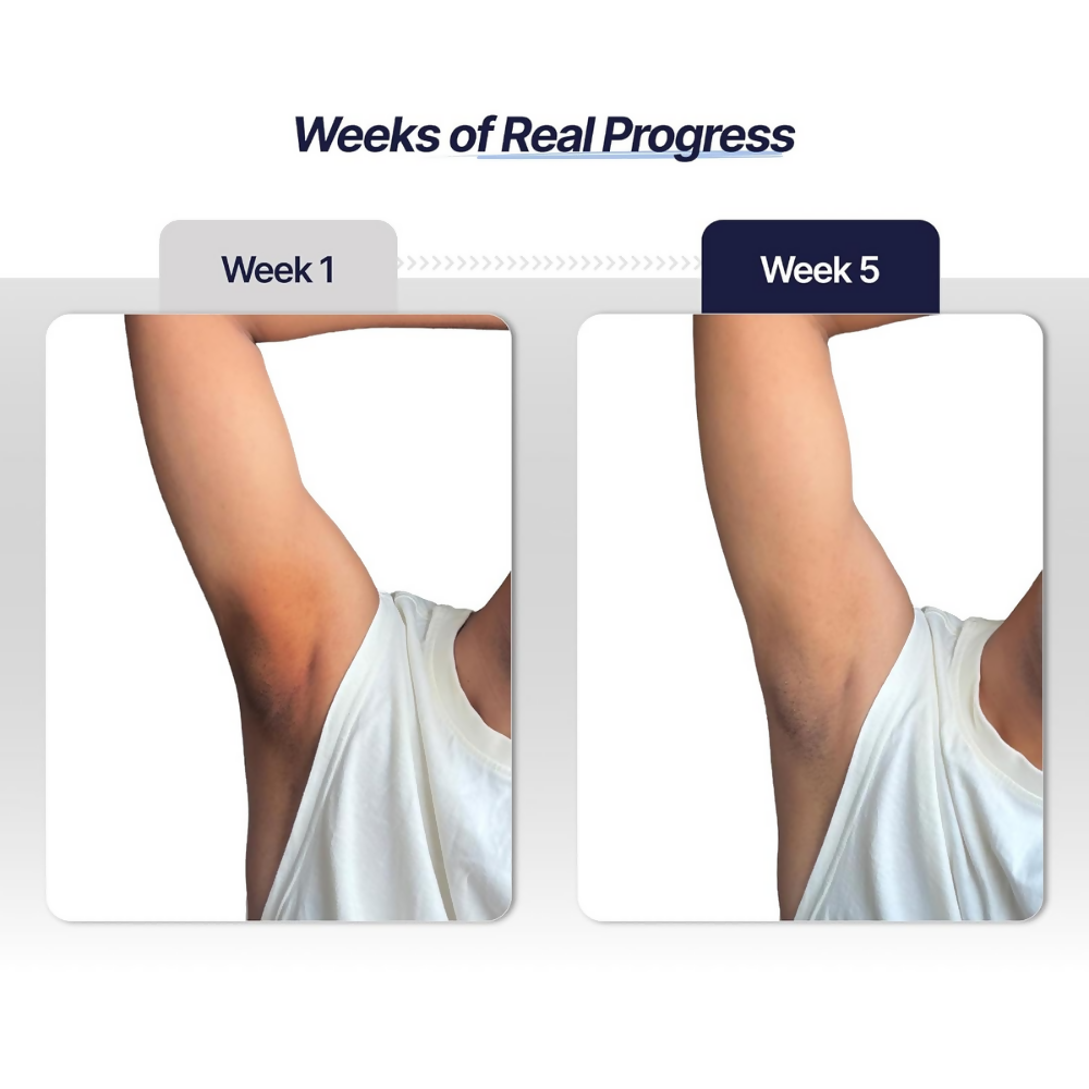 Mannlich Underarm Roll-On for Men | Grocsy