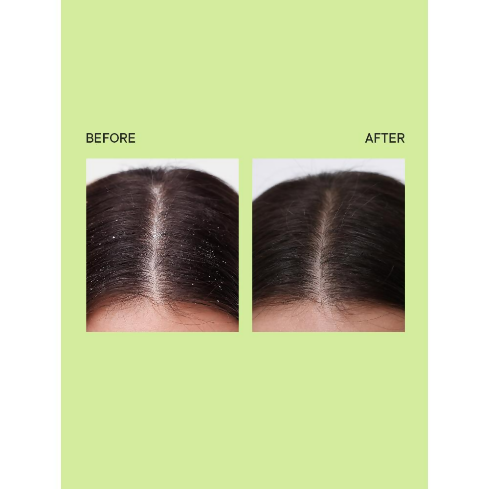 Quench Anti Dandruff Shampoo | Grocsy