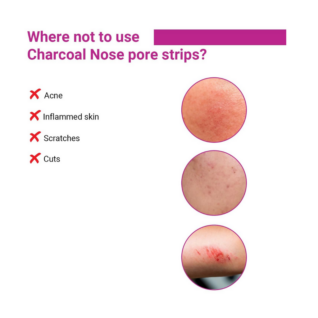 Sotrue Charcoal Nose Pore Deep Cleansing Strips | Grocsy