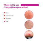 Sotrue Charcoal Nose Pore Deep Cleansing Strips | Grocsy